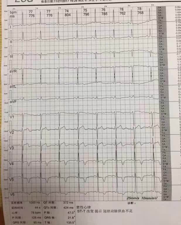 1572850796432555.jpeg 11172046_1.jpeg