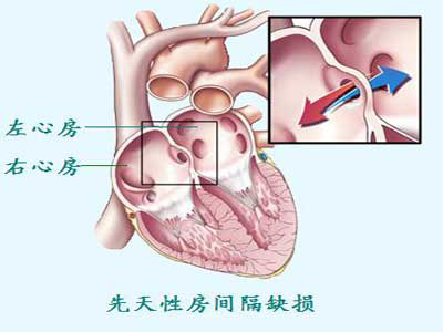 1572852432286290.png 11077471_1.png