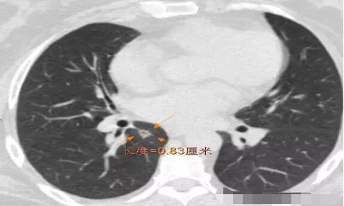 1573094202896093.jpg n3PF6HFW_EEnT.jpg