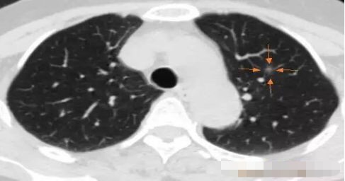 1573094545809040.jpg 1.jpg