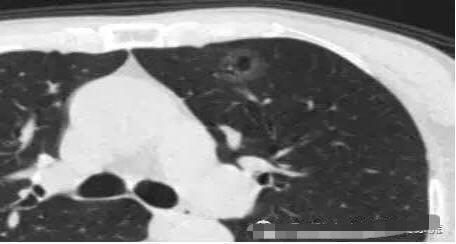 1573095166124990.jpg 2.jpg