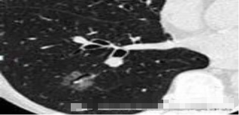 1573095208907540.jpg 4.jpg