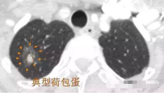 1573095249331861.jpg 6.jpg