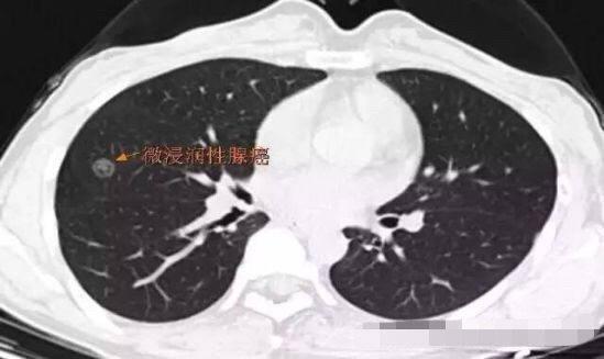 1573095280375280.jpg 11.jpg