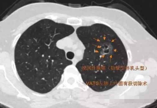 1573095298643798.jpg 2.jpg